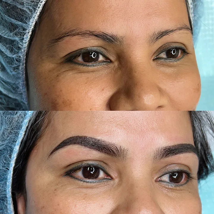 Nanoblading healed brows
